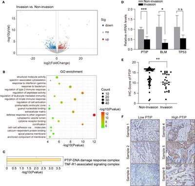 PTIP Inhibits Cell Invasion in Esophageal Squamous Cell Carcinoma via Modulation of EphA2 Expression